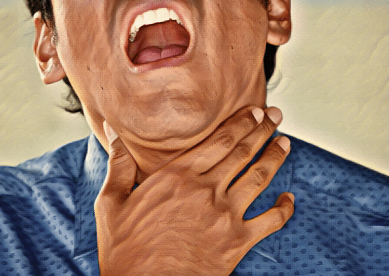 Illustration of choking, unable to breathe