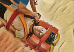 A girl suffering spinal injury